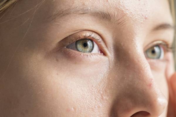 لنز چشم مناسب رنگ پوست‌های سبزه و روشن