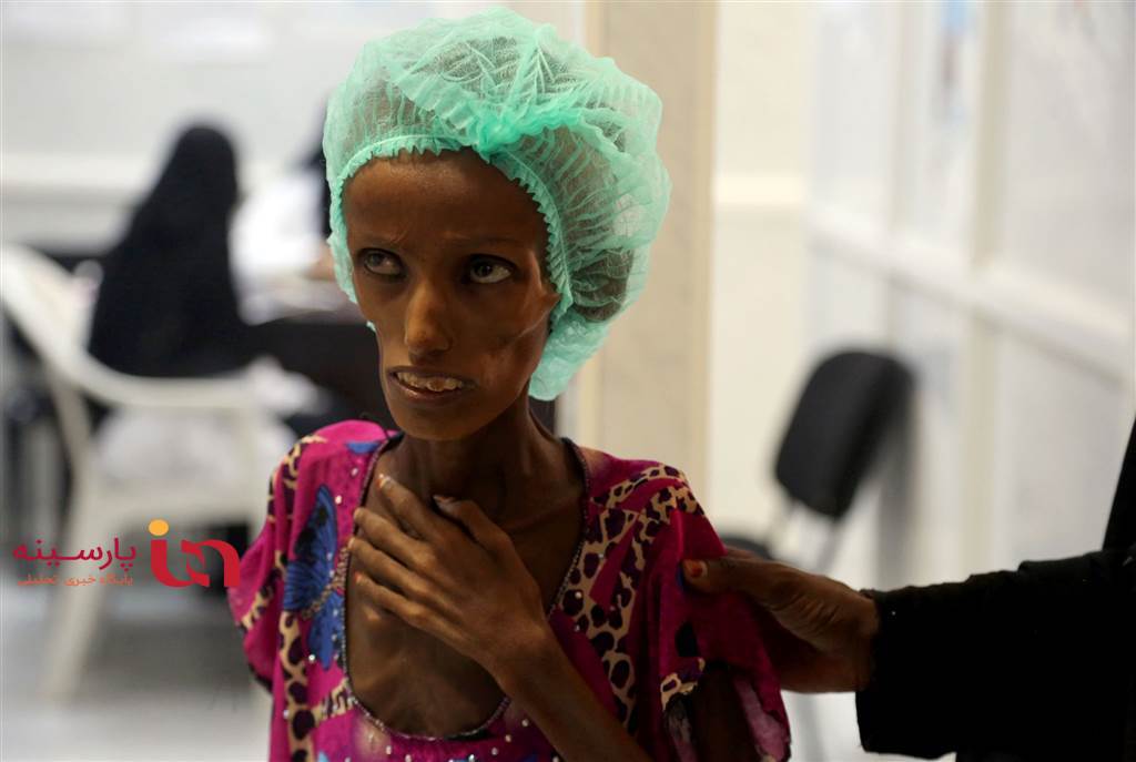 روزگار تلخ مردم غرق شده در گرسنگی یمن