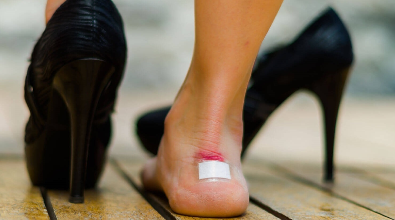 پیشگیری و درمان تاول پاها+ زمان مراجعه به پزشک