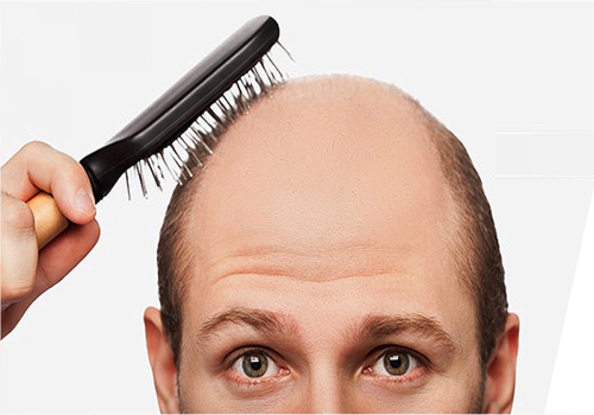 فرمول‌های طبیعی برای تقویت رشد مو+ علل ریزش