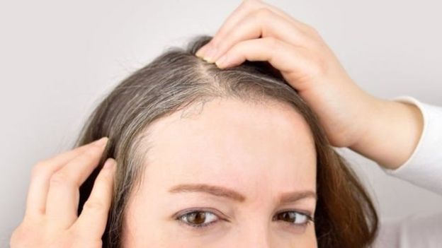 نشریه نیچر: تأثیر غیر قابل انکار استرس بر سفید شدن موی انسان