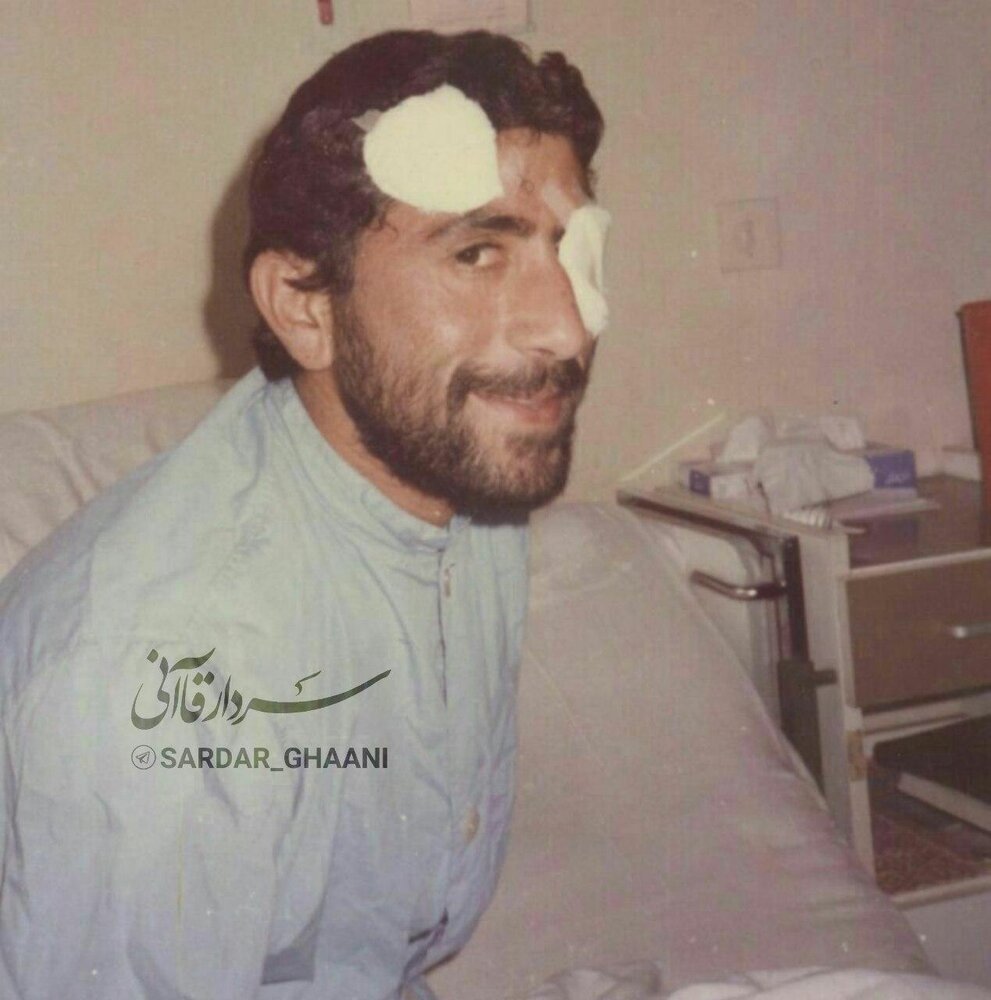 مجروحیت چشم سردار قاآنی در دوران دفاع مقدس +عکس