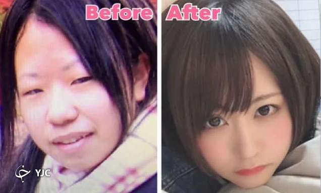 حیرت کاربران از تغییر چهره دختر ژاپنی پس از جراحی پلاستیک! + عکس