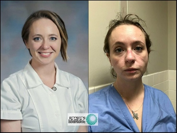 پرستار آمریکایی قبل و بعد از شیوع کرونا+عکس