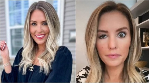 بلایی که بوتاکس بر سر یک اینفلوئنسر اینستاگرام آورد +عکس بلایی که بوتاکس بر سر یک اینفلوئنسر اینستاگرام آورد +عکس