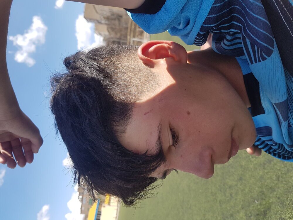 درگیری در لیگ نونهالان با چاقو و قمه + عکس