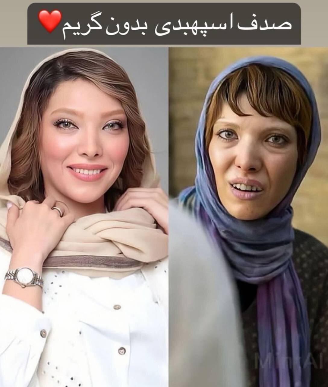 تفاوت چهره حیرت انگیز خانم بازیگر بدون گریم فیلم معروف+ عکس